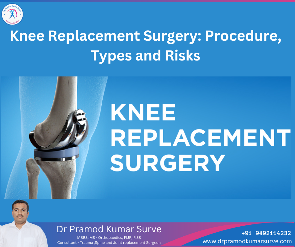 Knee Replacement Surgeon in hadapsar.