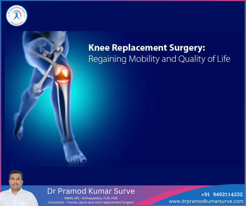 Knee Replacement Surgery