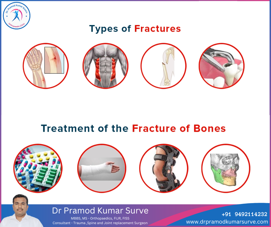 Bone Fracture tretment in pune