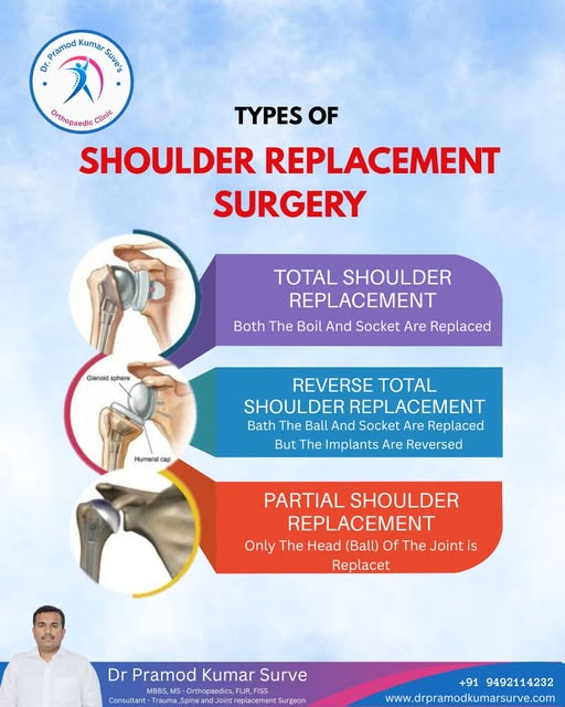 Shoulder Replacement Surgery in pune
