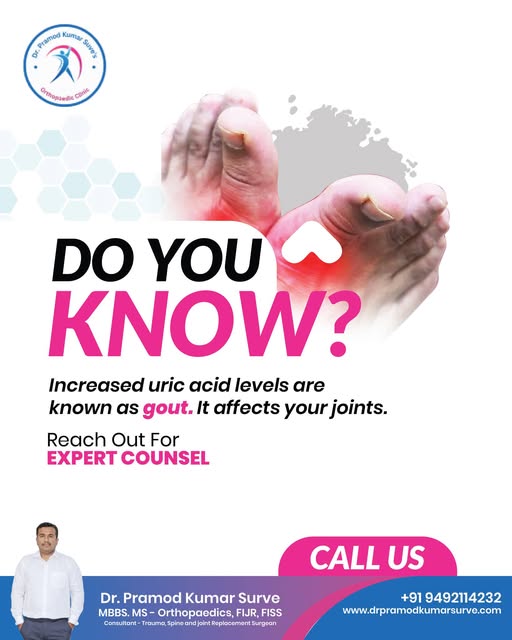 High Uric Acid and Joint Pain